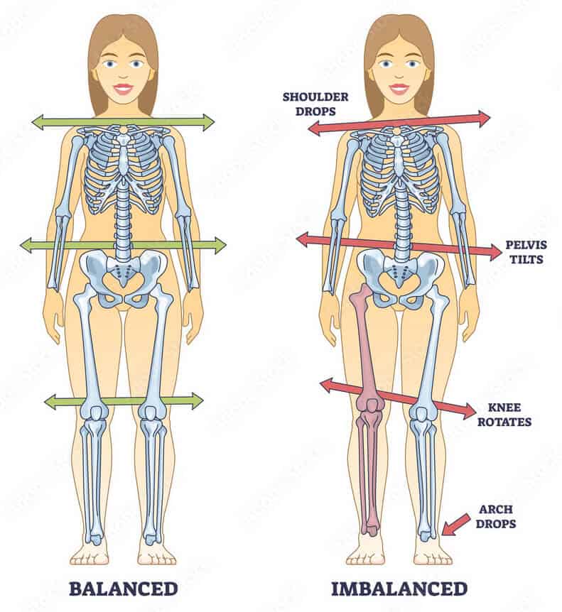 Posture Correction 1 Proper spinal alignment and posture correction at Antignolo Chiropractic.